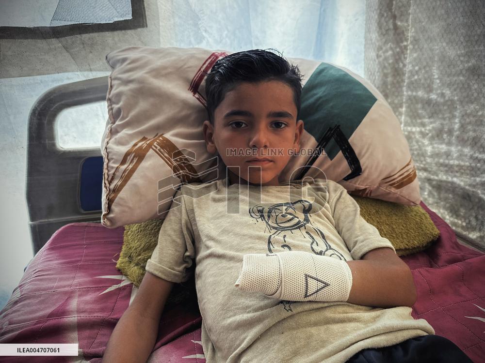 Child Loses Arm in Israel Gaza Conflict