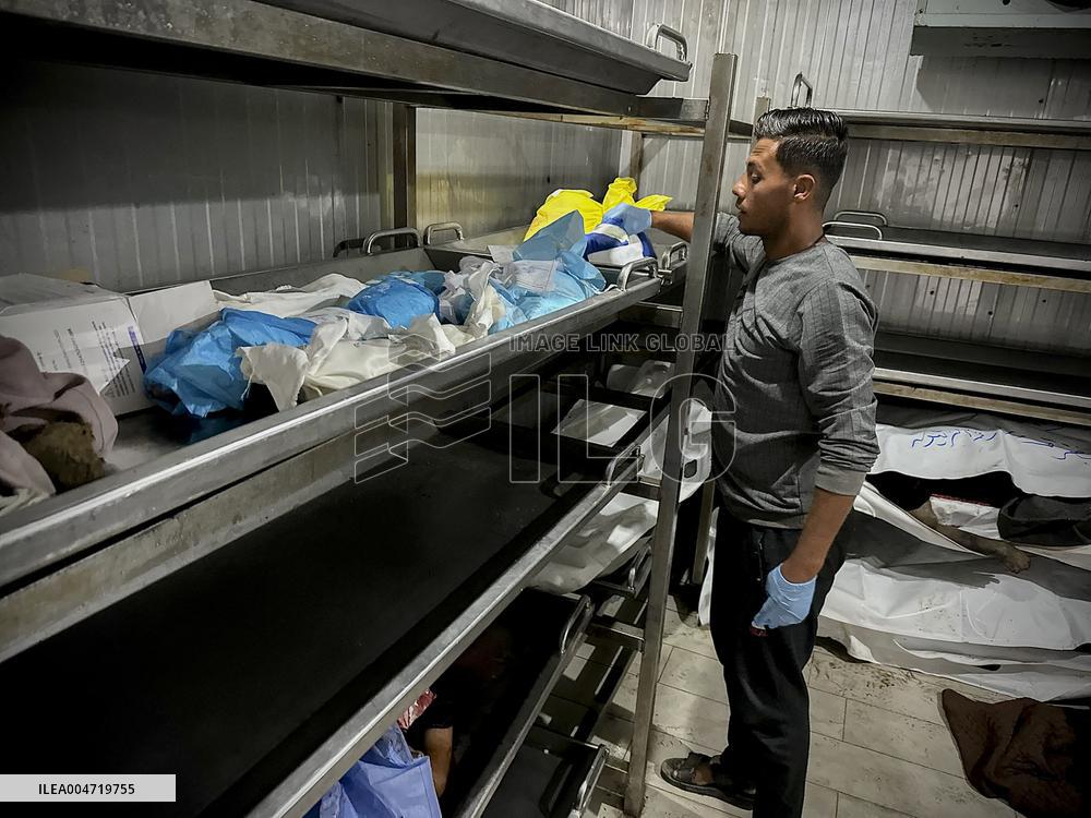 Children Die Amid Malnutrition in Khan Yunis - Palestine