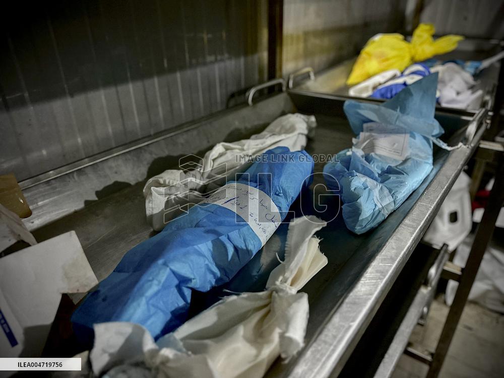 Children Die Amid Malnutrition in Khan Yunis - Palestine