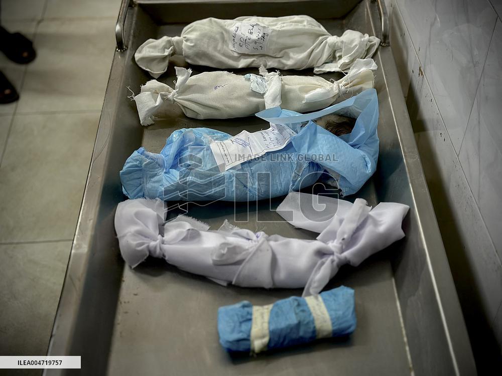 Children Die Amid Malnutrition in Khan Yunis - Palestine