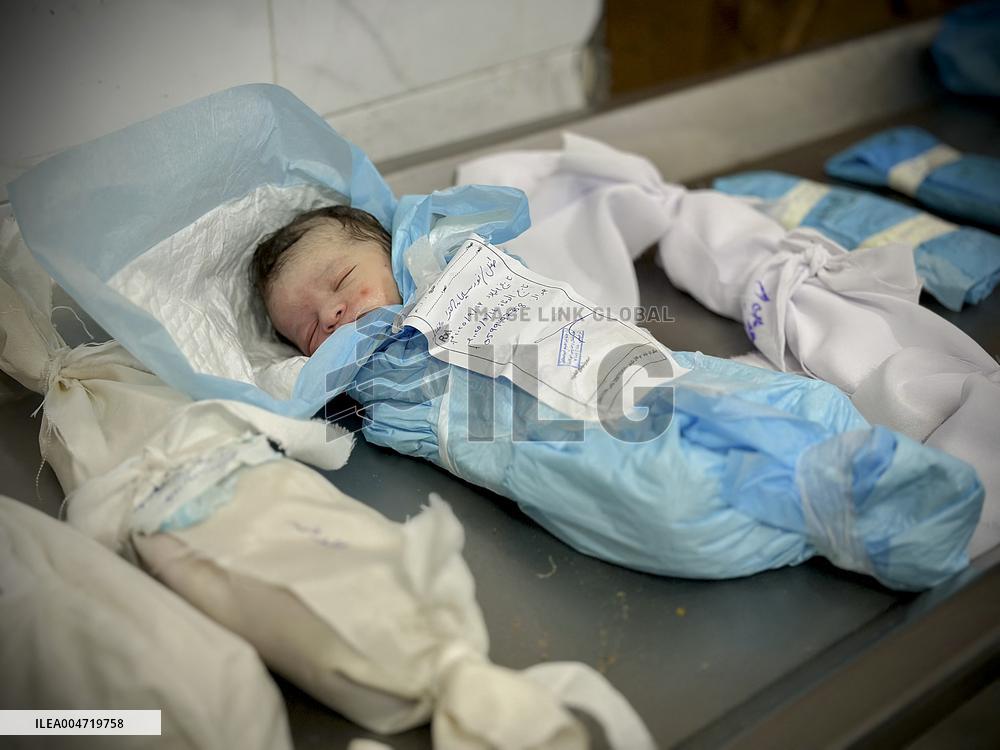 Children Die Amid Malnutrition in Khan Yunis - Palestine