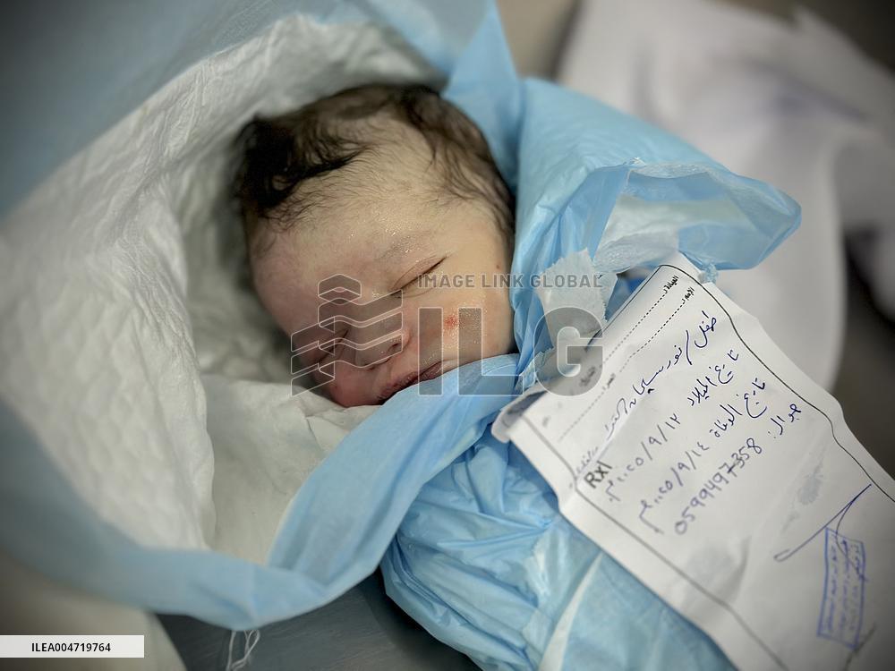 Children Die Amid Malnutrition in Khan Yunis - Palestine