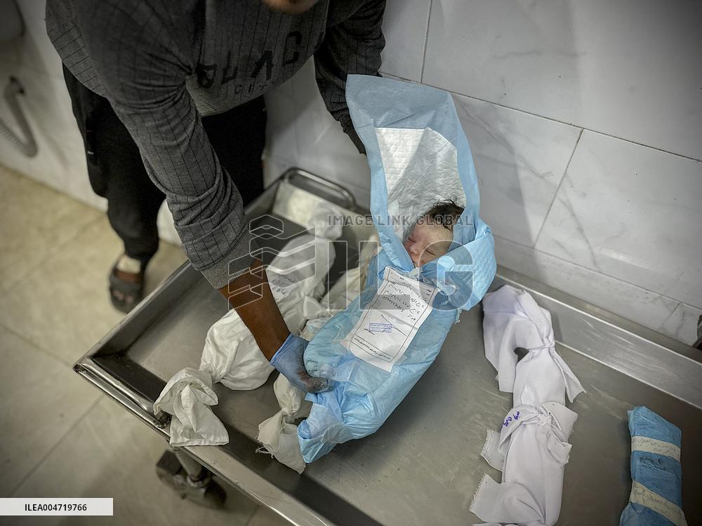 Children Die Amid Malnutrition in Khan Yunis - Palestine