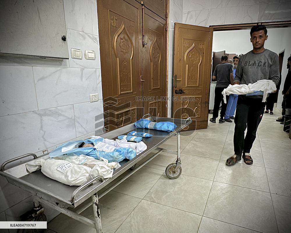 Children Die Amid Malnutrition in Khan Yunis - Palestine