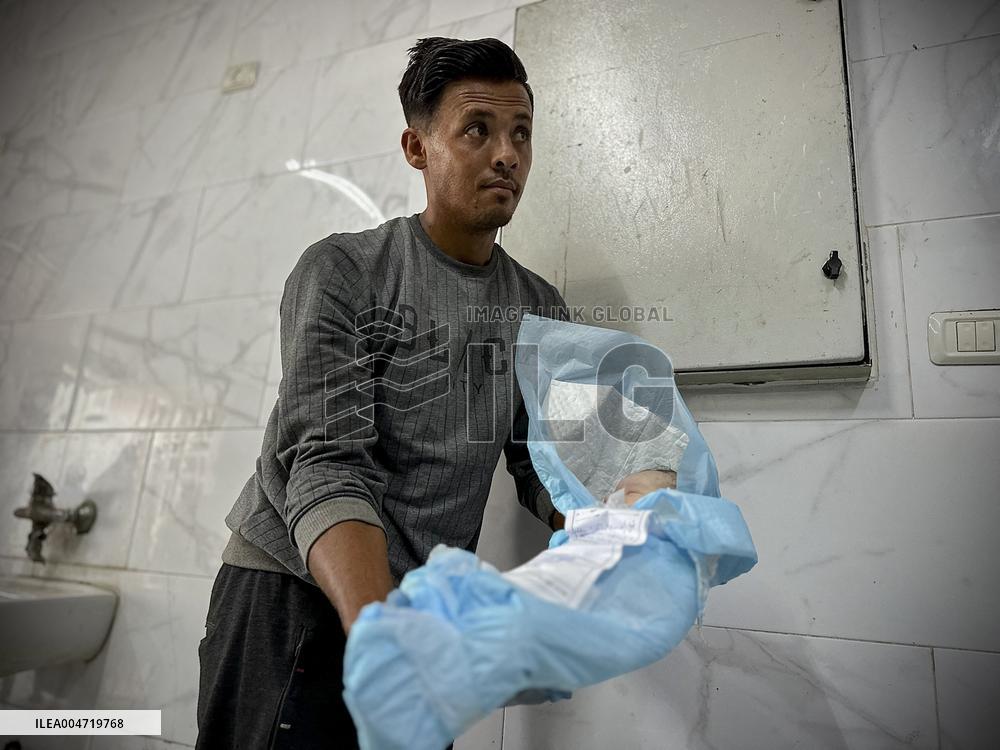 Children Die Amid Malnutrition in Khan Yunis - Palestine