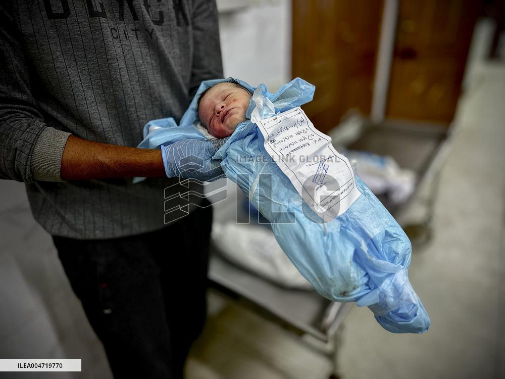 Children Die Amid Malnutrition in Khan Yunis - Palestine