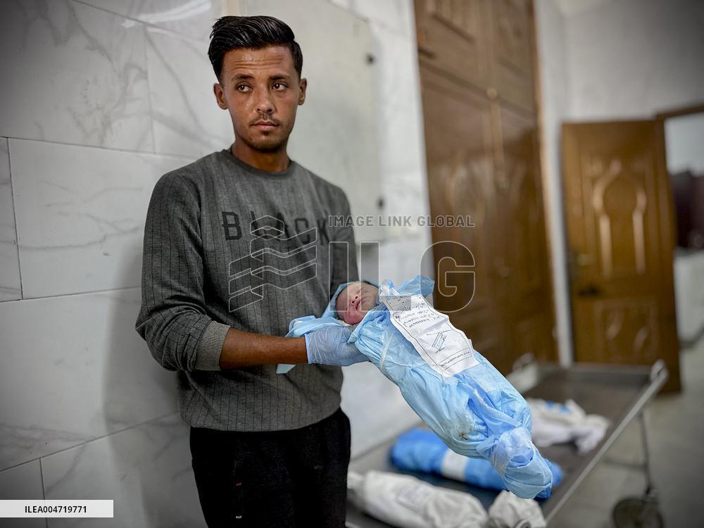 Children Die Amid Malnutrition in Khan Yunis - Palestine