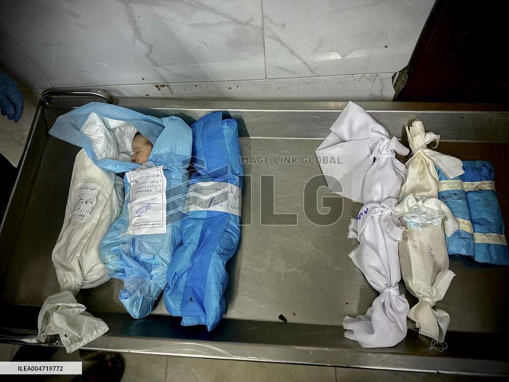 Children Die Amid Malnutrition in Khan Yunis - Palestine