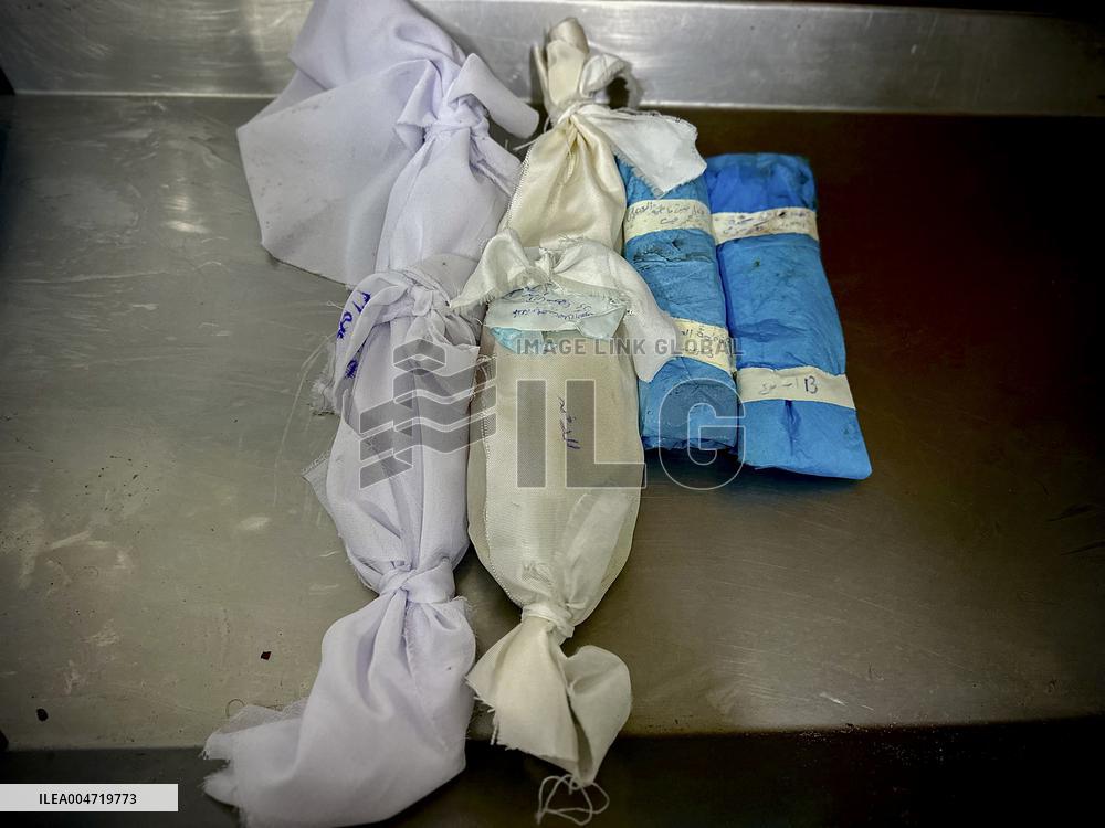 Children Die Amid Malnutrition in Khan Yunis - Palestine