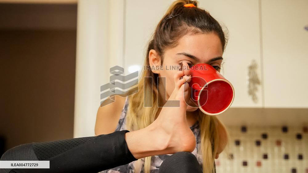 Turkish Paralympic Swimmer Sevilay Ozturk