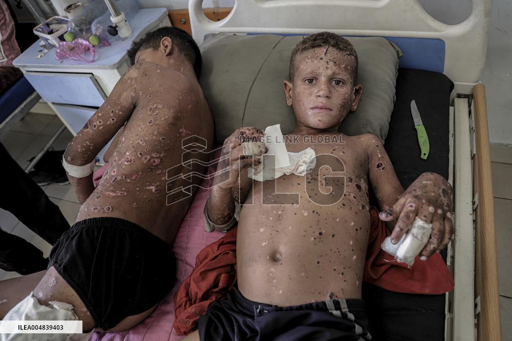 Injured Gaza Children - Palestine