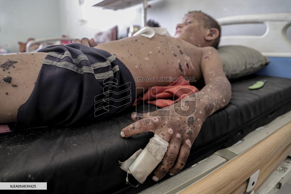Injured Gaza Children - Palestine