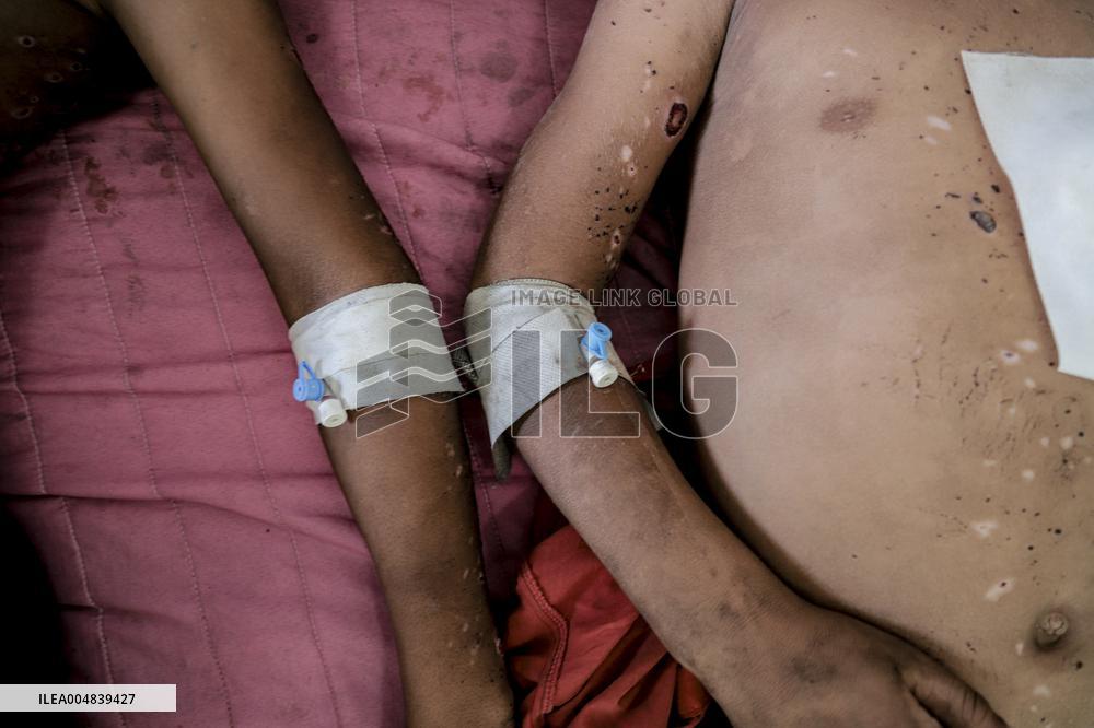 Injured Gaza Children - Palestine