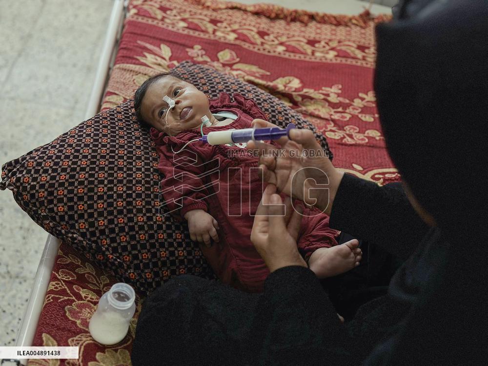 Gaza Baby With Beckwith-Wiedemann Syndrome - Palestine