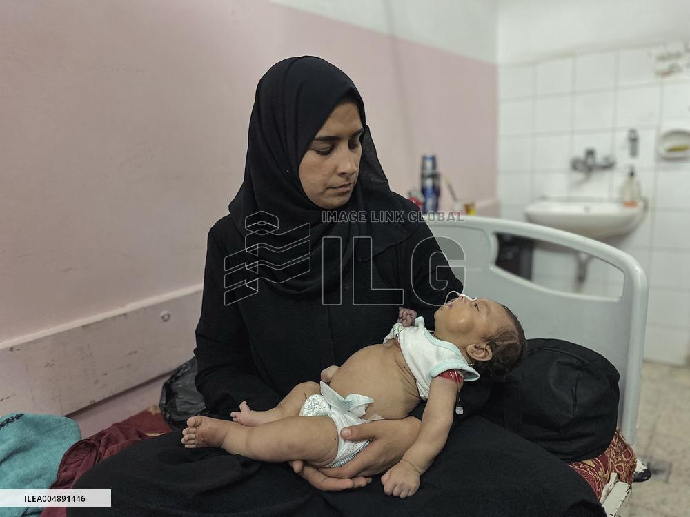 Gaza Baby With Beckwith-Wiedemann Syndrome - Palestine