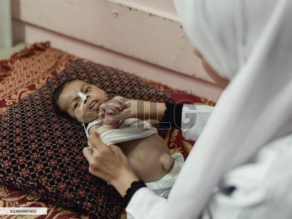 Gaza Baby With Beckwith-Wiedemann Syndrome - Palestine