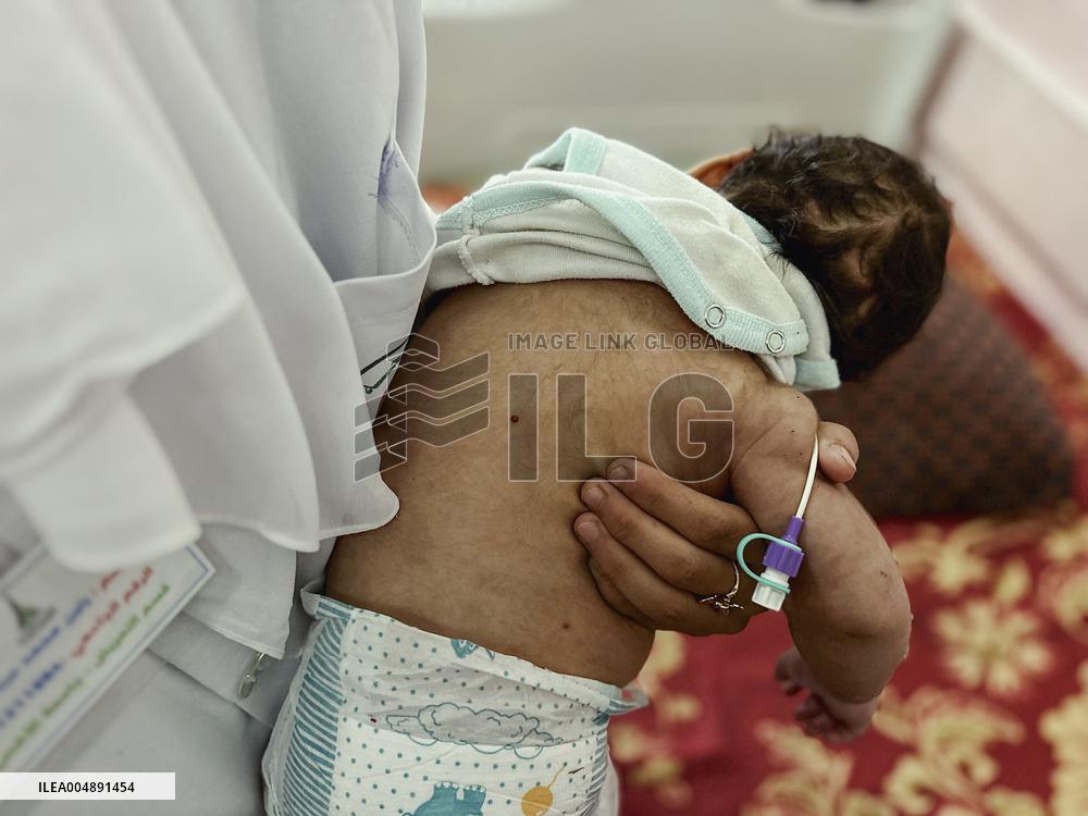 Gaza Baby With Beckwith-Wiedemann Syndrome - Palestine