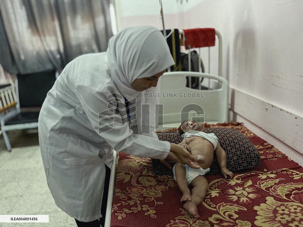 Gaza Baby With Beckwith-Wiedemann Syndrome - Palestine