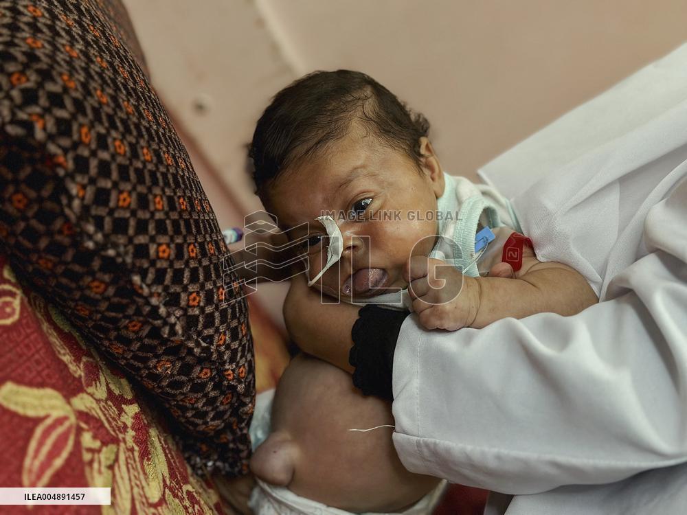 Gaza Baby With Beckwith-Wiedemann Syndrome - Palestine