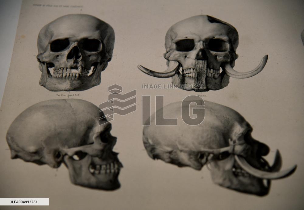 Mummies at the Museum of Mankind - Paris