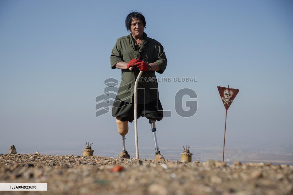 Iraqi Deminer Loses Legs Clearing Mines - Iraq