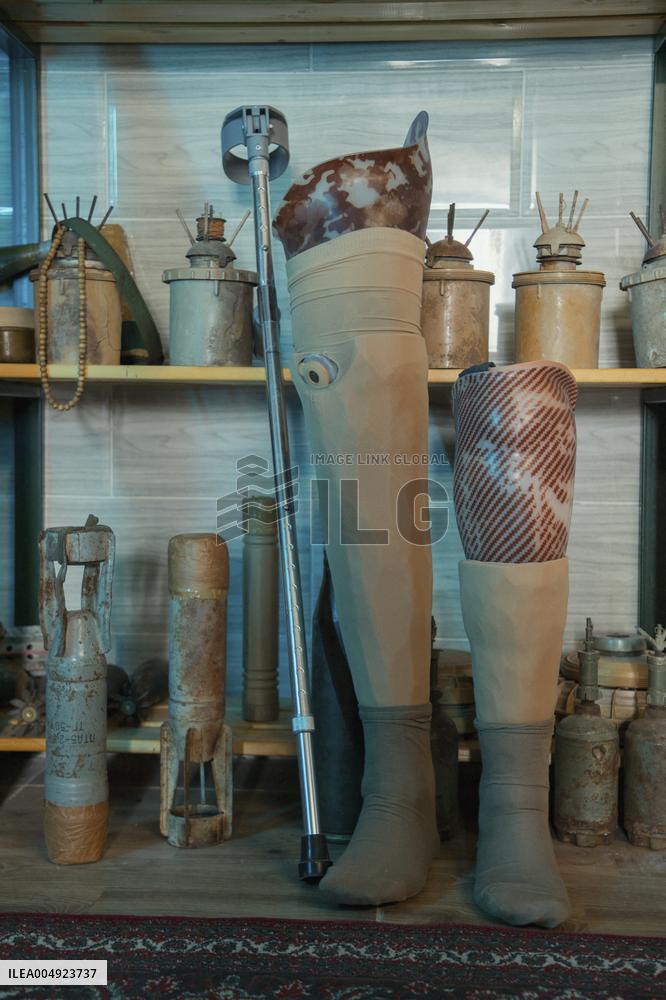 Iraqi Deminer Loses Legs Clearing Mines - Iraq