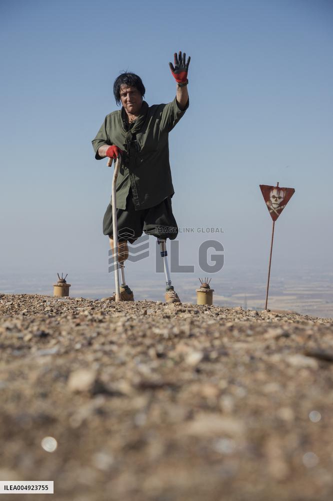 Iraqi Deminer Loses Legs Clearing Mines - Iraq