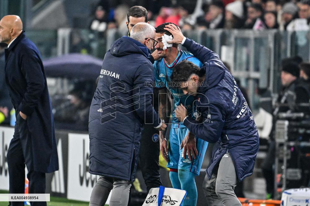 CALCIO - Serie A - Juventus FC vs Cagliari Calcio
