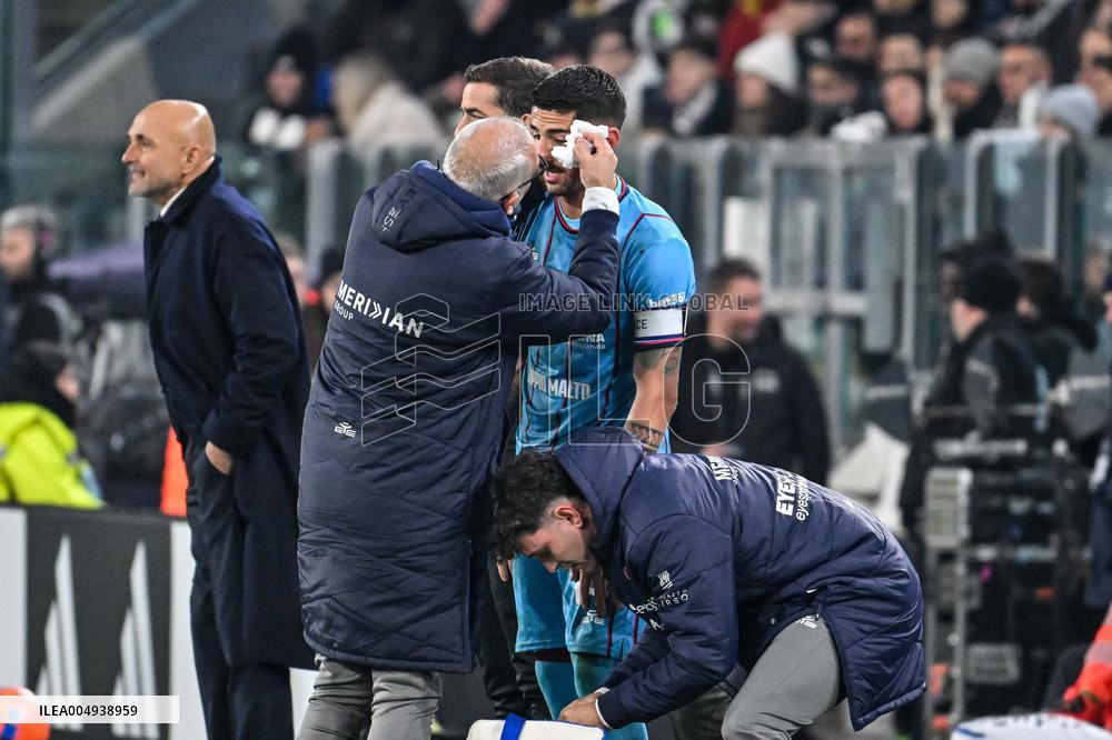 CALCIO - Serie A - Juventus FC vs Cagliari Calcio