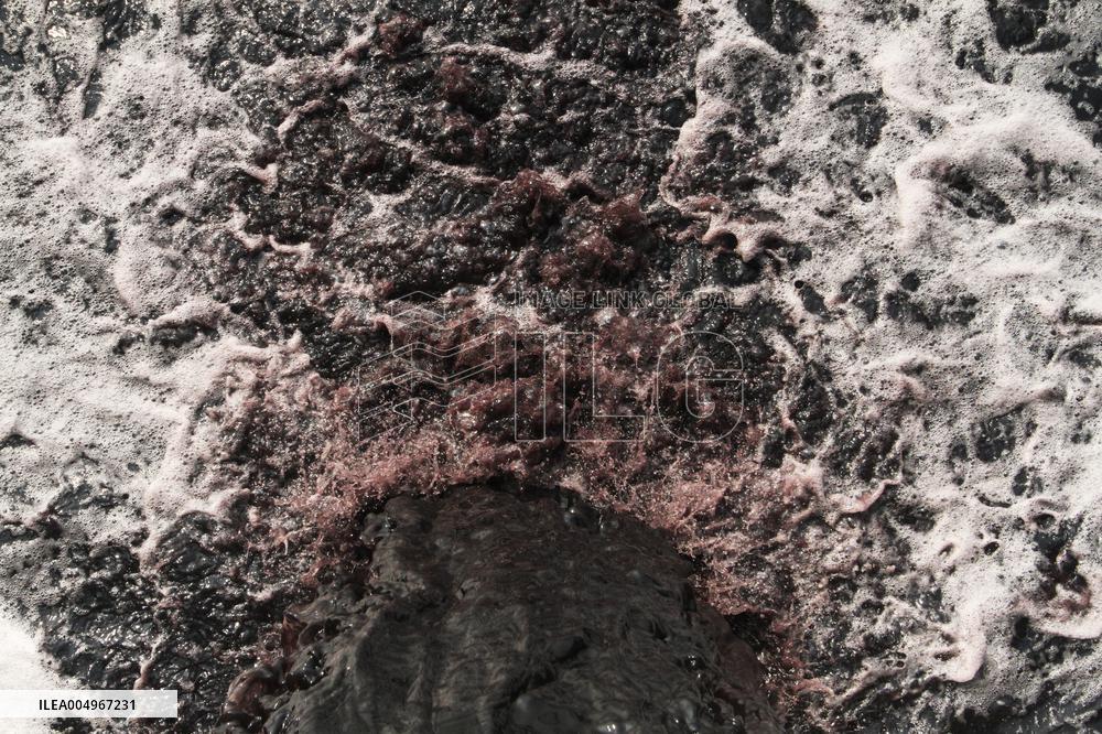 River Pollution - Dhaka