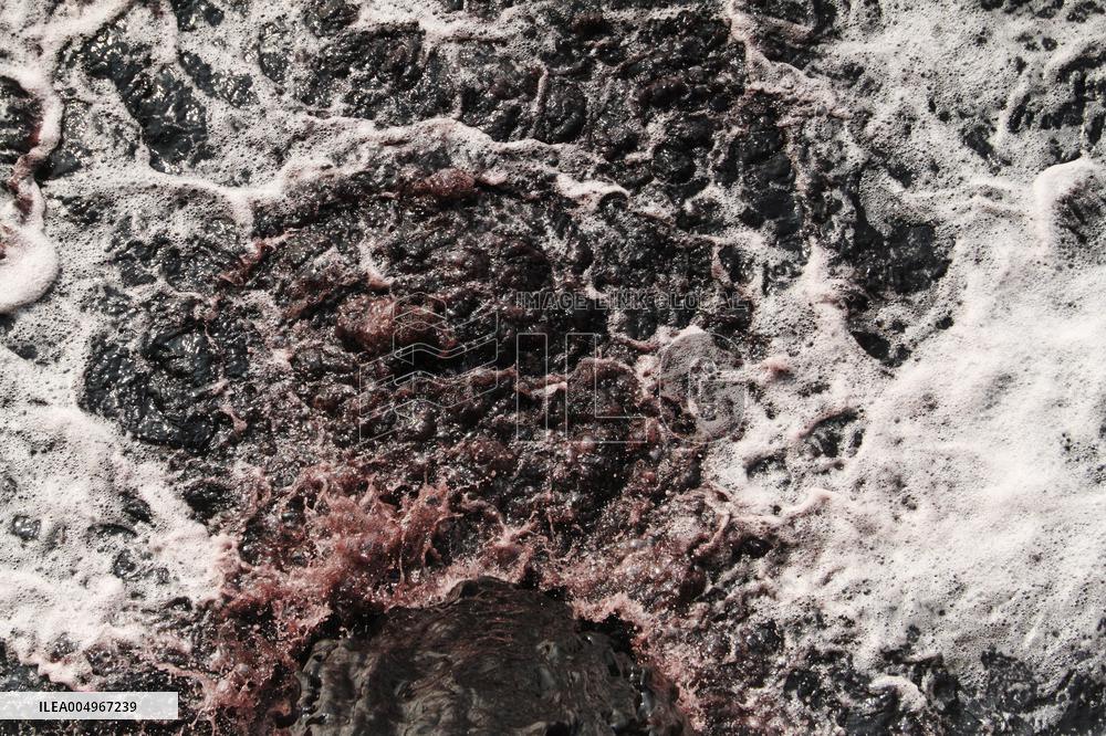 River Pollution - Dhaka