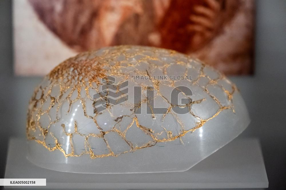 Medal Cabinet Reopens After Six-Year Hiatus - Rome