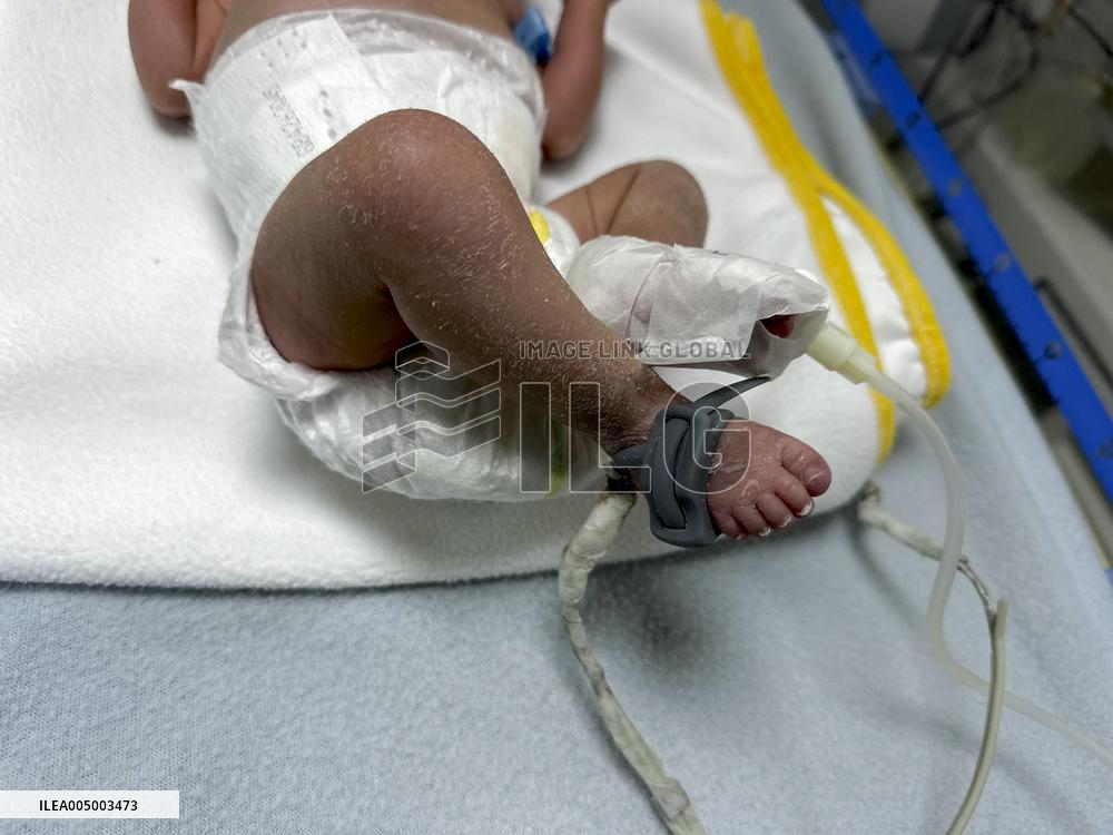 Infant Dead Because of Hypothermia - Gaza