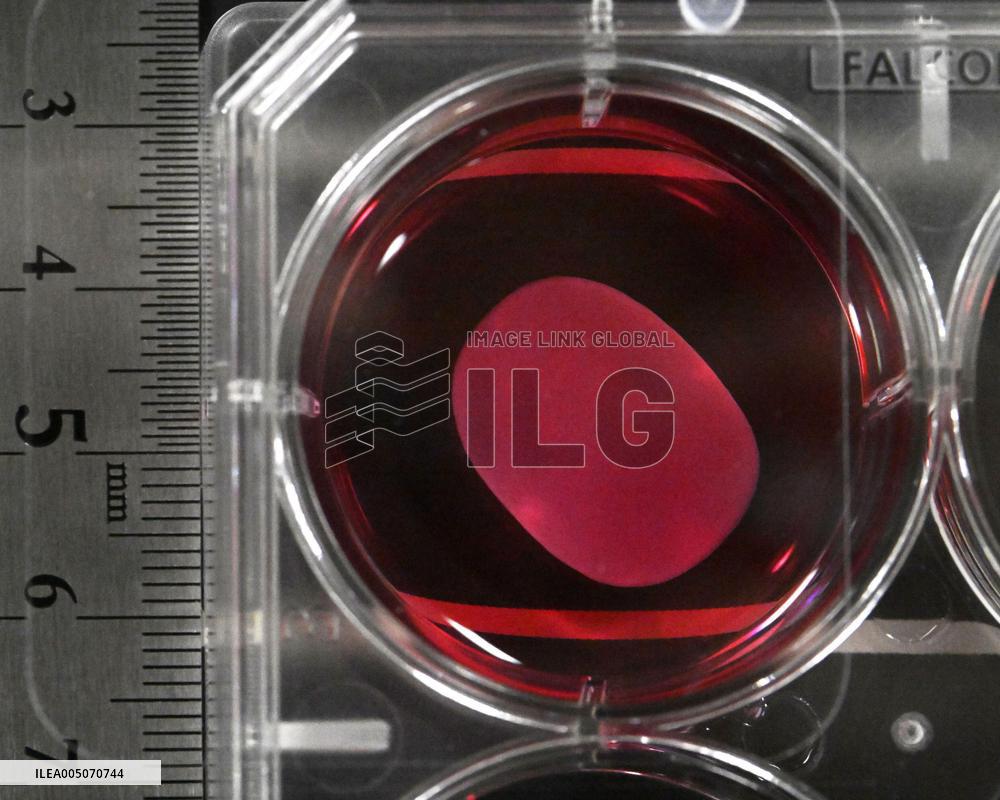 Japan gov't panel approves 2 iPS-derived drugs